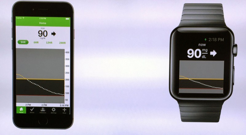 The Apple Watch Can Measure Our Glucose from Launch